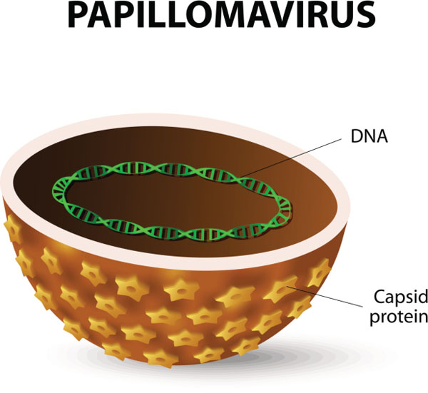 Papilloma Virus, cosa è e come si cura
