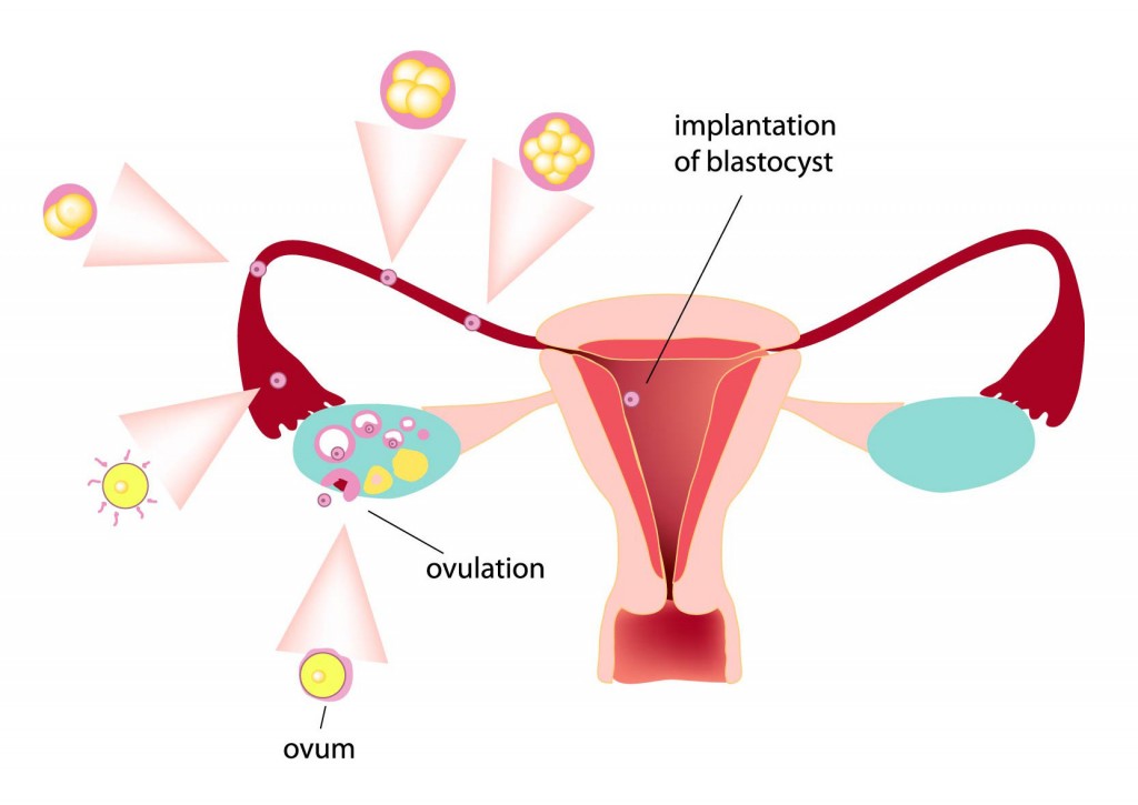 concepimento-impianto