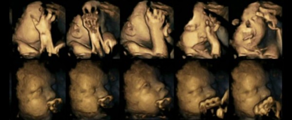 Fumi in gravidanza? Ecco cosa succede al feto - video ECO 4D