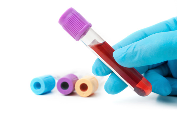 Tumore alle ovaie, prevenirlo grazie a un test del sangue?