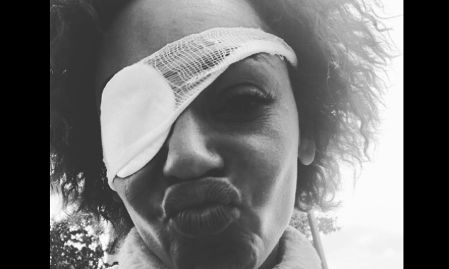 Mel B